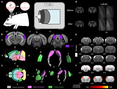 Structural Alterations in a Rat Model of Short-Term Conductive Hearing Loss Are Associated With Reduced Resting State Functional Connectivity